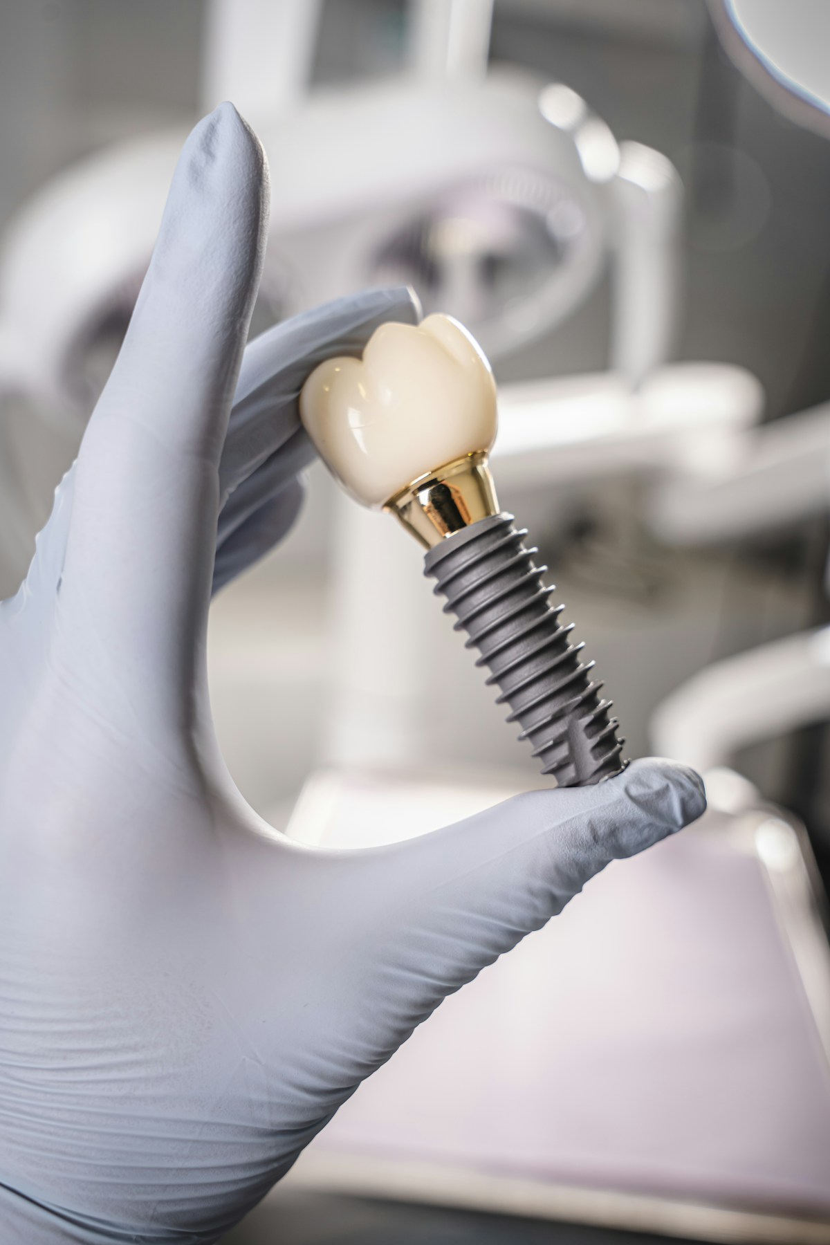 Titanyum implant vida, abutment ve diş kronu bileşenleri — implant üstü protez planlaması